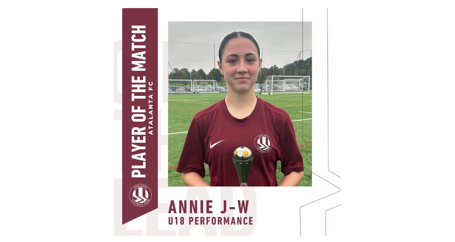 Under 18 Performance Squad vs Fulham Women 